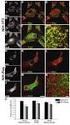 Extracellular. Intracellular. Endoplasmic reticulum