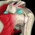 La valutazione ecografica nella sindrome conflittuale della spalla: studio su casi