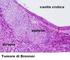 TERAPIA MEDICA DEL CARCINOMA A CELLULE TRANSIZIONALI DELLA VESCICA METASTATICO EDIZIONI MINERVA MEDICA