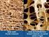 DIFFERENZE TRA OSTEOPENIA E OSTEOPOROSI: LA PREVENZIONE DELLE FRATTURE. Umberto Tarantino