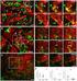 Interactions between Lymphatic Vessels and Leukocytes: Elucidating their impact on lymphatic function and immunity