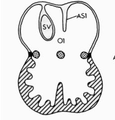 DIFFERENT TYPES OF ASD Development of the atrial septum Septum primum