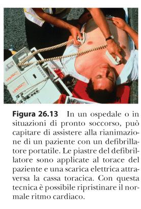 Defibrillatore Una batteria carica un condensatore ad elevata d.d.p, immagazzinando una grande quantità di energia in meno di un secondo.