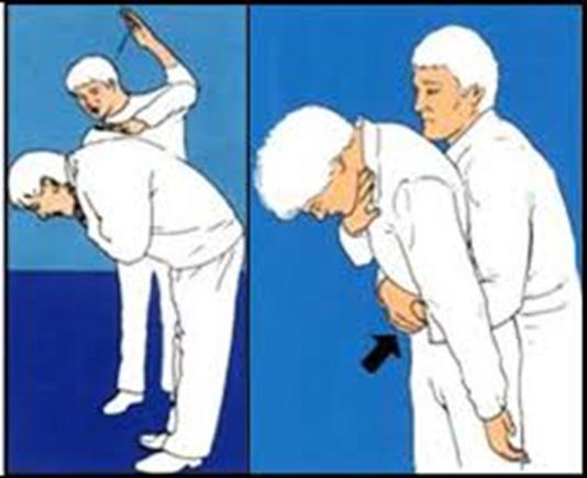 Tecnica delle manovre di Heimlich Se la vittima è in piedi o seduta: il soccorritore si posiziona alle spalle del paziente; pone entrambe le braccia attorno alla vita del paziente; pone una mano