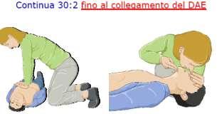 frequenza di 100 min. Fig. 13 A Fig.