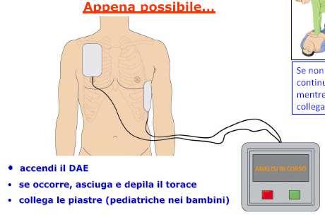 eventuali cerotti, senti se ci sono dei dispositivi sottocutanei. Posiziona le placche: 1.