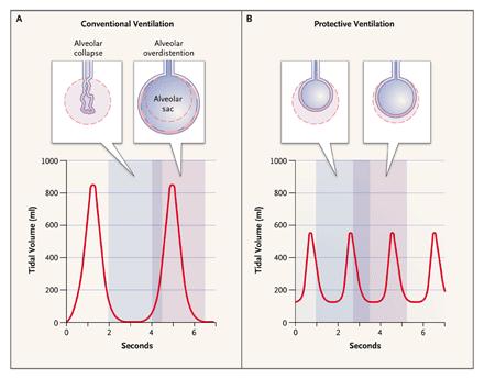 Conventional versus