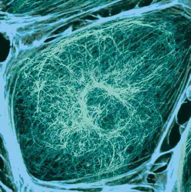 microtubuli, microfilamenti e filamenti intermedi) dà forma e