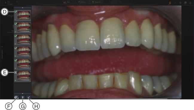 3 Uso Sirona Dental Systems GmbH 3.5 Salvataggio ed eliminazione di immagini fisse in Sidexis 4 Plugin video per SIDEXIS 4 TENEO / SINIUS / INTEGO 3.