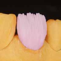 LINEE GUIDA BASE Stratificazione Costruzione anatomica completa del dente con dentina e taglio della dentina nel terzo incisale.