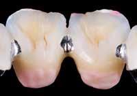 30: ribasamento Indicazione: è possibile lavorare senza o con massa da glasure.