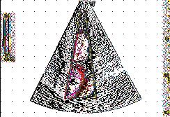 Sezione sagittale di prostata in immagine di struttura cistica con sonde E8CS,ottenuta con imaging fondamentale e SRI Real-time 4D Imaging.