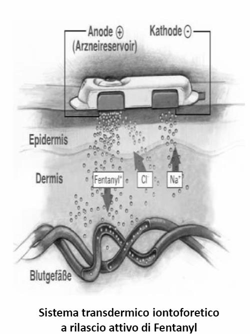 FENTANYL Fentanyl Vie di somministrazione orale FENTANYL (DUROGESIC ) Fentanyl (Actiq) Somministrazione transdermica Assorbimento lento rilasciamento continuo concentrazioni ematiche