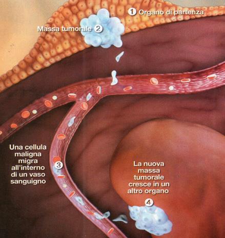 ALIMENTAZIONE E CANCRO Gli studiosi concordano nel ritenere che l 80-90% di tutti i tumori umani sia causato da fattori ambientali, tra cui primeggiano l