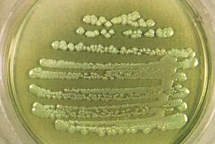 Pseudomonas aeruginosa v La sua presenza è indice di inefficaci trattamenti di potabilizzazione v Bacillo gram negativo v Diffuso nel suolo, nell acqua, nell aria ma anche nelle feci v E considerato