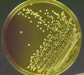 Staphylococcus aureus v Cocco Gram positivo v Appartiene alla famiglia delle Micrococcaceae v E l unica specie patogena per l uomo con una frequenza di portatori nasali di circa il 20%.