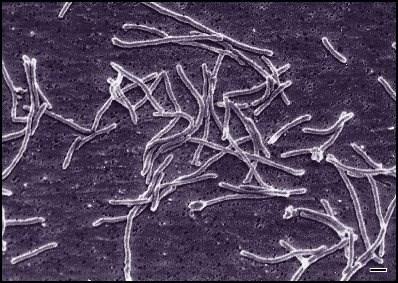 DNA polimerasi del Thermus aquaticus Thermus aquaticus è un batterio termofilo isolato per la prima volta nelle pozze di acqua calda del parco nazionale di Yellowstone, negli (Stati Uniti ).