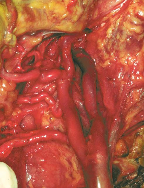 digastrico; 5) arteria carotide esterna; 6) vena giugulare esterna; 7) arteria sottomentoniera; 8) vena sottomentoniera; 9) muscolo digastrico Figura. C-D.