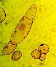 Colture cellulari Principali parametri chimico-fisici dell ambiente colturale: Luce (composizione spettrale, intensità e fotoperiodo) Temperatura Composizione chimica del mezzo