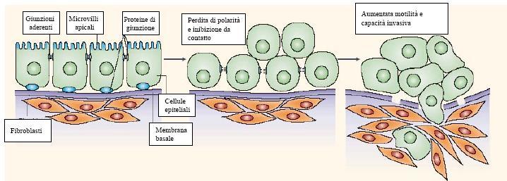 La cellula neoplastica diviene invasiva quando: