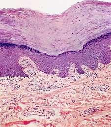 La pelle strato corneo Epidermide strato