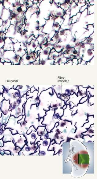 Le fibre reticolari: sono formate da molecole di collagene di