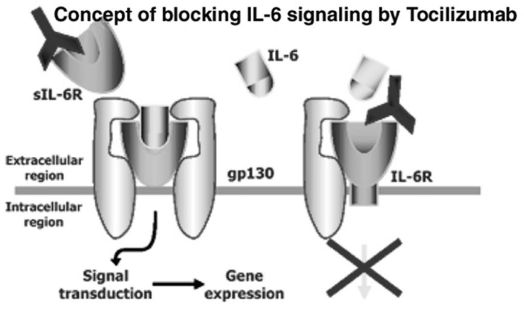 Antagonisti del recettore dell IL-6: Tocilizumab è un anticorpo umanizzato diretto contro il recettore dell IL-6, una