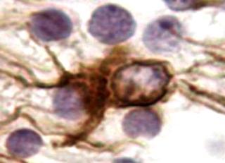 ippocampo PRES: presubiculum EC: corteccia