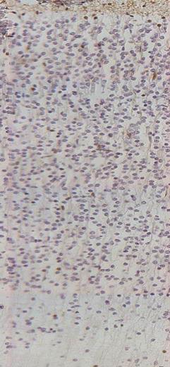 Thickness ( m) 1 8 6 4 2 Cells/mm 2 (1