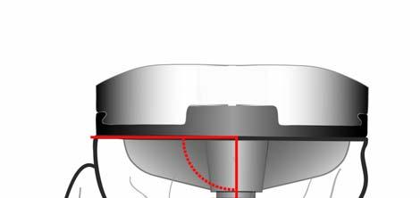 RISULTATI Posizione della componente tibiale rispetto alla