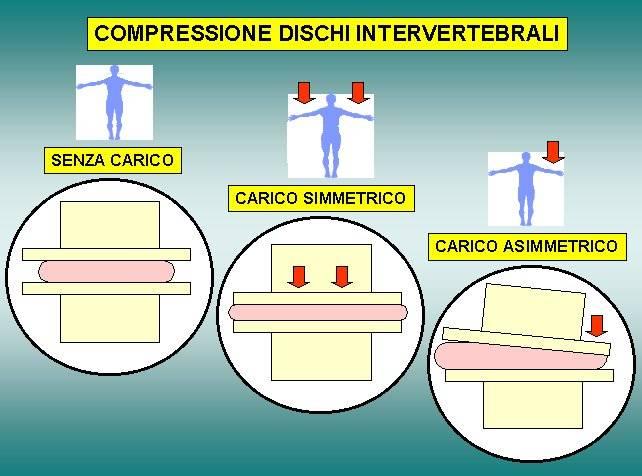 Movimentazione manuale dei carichi Il principale fattore che determina un rischio per la colonna vertebrale dell operatore è l