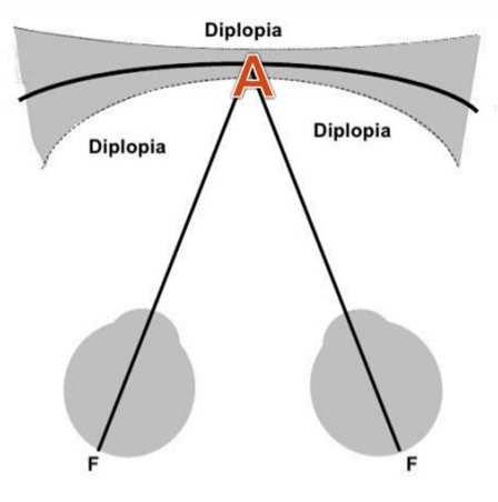L Area di Panum Intorno all Oroptero esiste un volume entro il quale pur verificandosi la disparità di fissazione questa non si traduce in Diplopia.