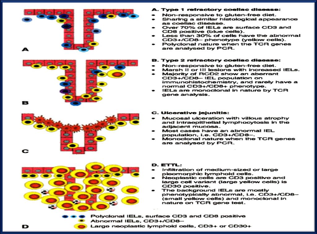 COMPLICANZE CELIACHIA: