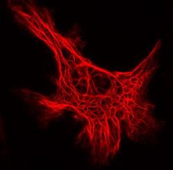 Microscopio a fluorescenza La sostanza fluorescente è una molecola che assorbe la luce ad una lunghezza d onda ed emette luce