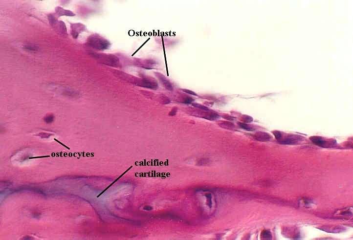 osteoblasti, osteoide e osteociti immagine istologica di osteoblasti allineati lungo la