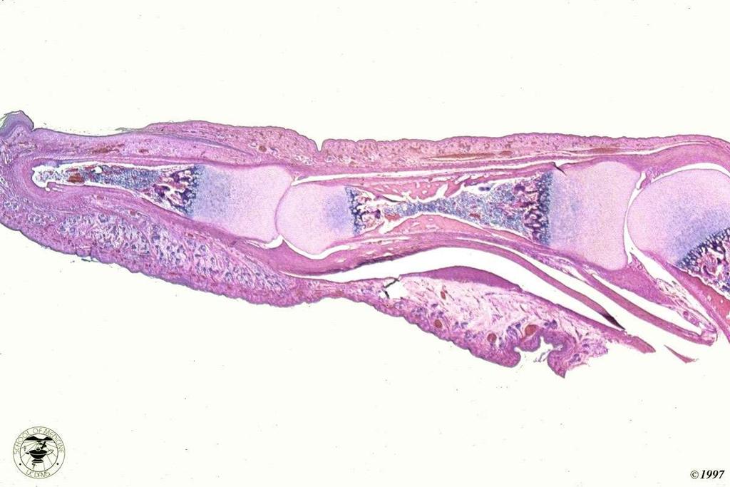 ruolo della cartilagine nello sviluppo dell osso sezione di dito durante lo sviluppo fetale osso in via di