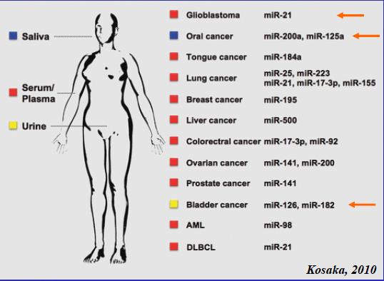 diagnostici * # AML: acute