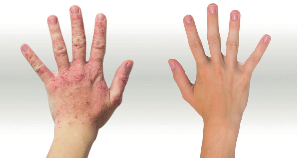Bild: SUVA Protezione delle mani Proteggere Evitare ogni contatto con sostanze dannose.