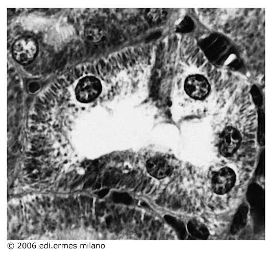 di tutti i mitocondri della cellula e detto Condrioma Sezione trasversale di tubulo renale con