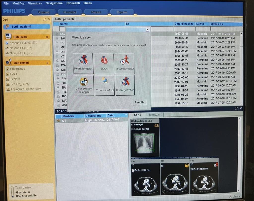 È un software che offre supporto per la navigazione di dispositivi tramite la sovrapposizione di immagini 3D diagnostiche (TC/RM) acquisite in precedenza ad immagini fluoroscopiche in