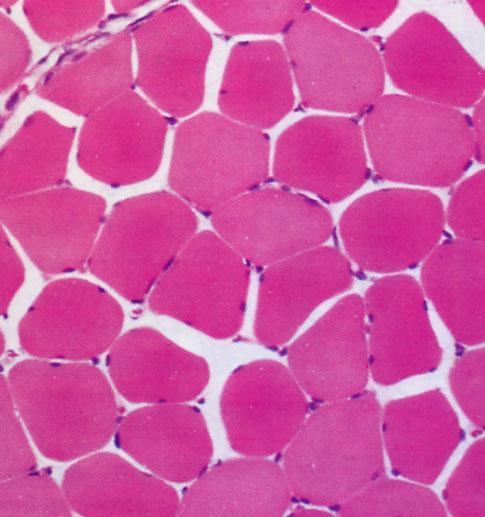 ST Sezioni di muscolo scheletrico fissato e colorato con E&E