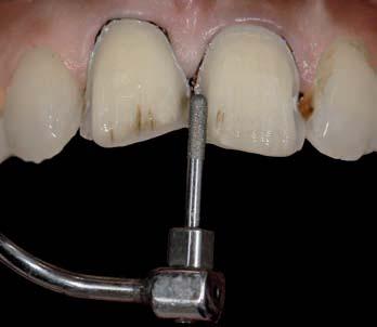 dentale rifinita 5