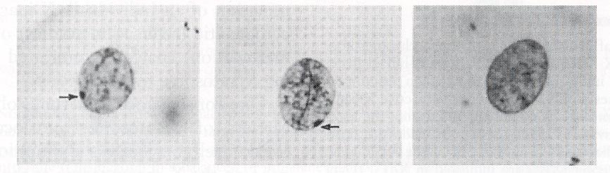 Inattivazione di un cromosoma X nell embrione femmina (blastocisti) Il cromosoma X inattivo non esprime i geni ed è