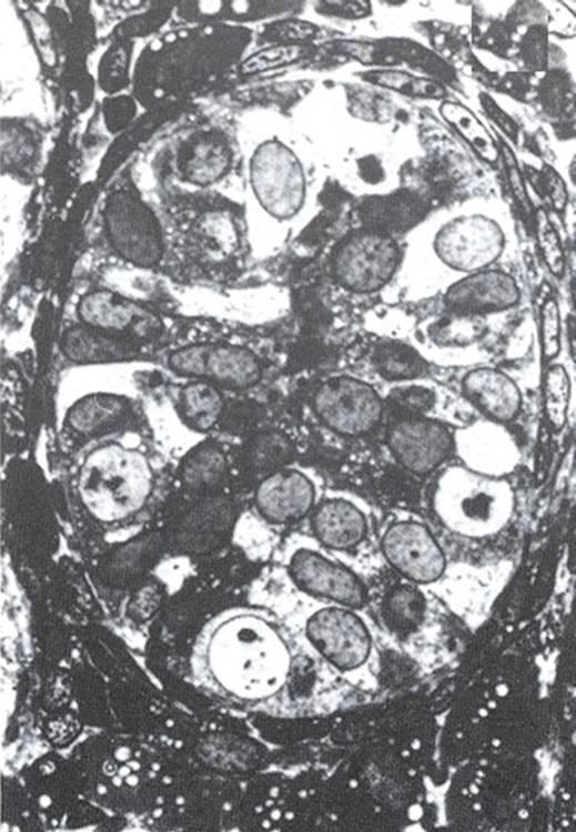 XY Spermatogenesi embrio-fetale: cellula pre-leydig -Prospermatogoni -Cordoni