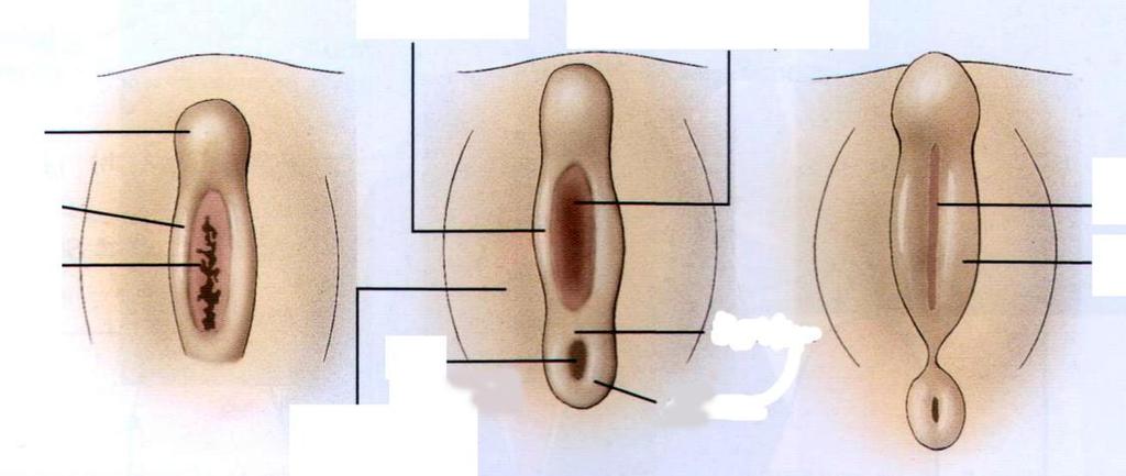 Sviluppo dei genitali esterni pieghe urogenitali membrana urogenitale tubercolo genitale pieghe cloacali