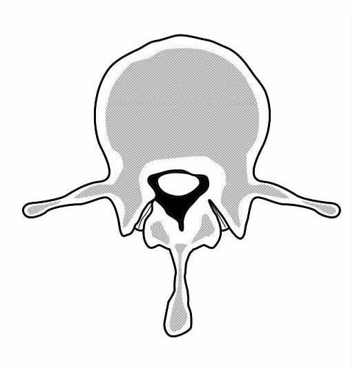 PATOLOGIA DEL RACHIDE LOMBARE Il movimento e il carico generano modificazioni e usura dei tessuti nel corso della vita.