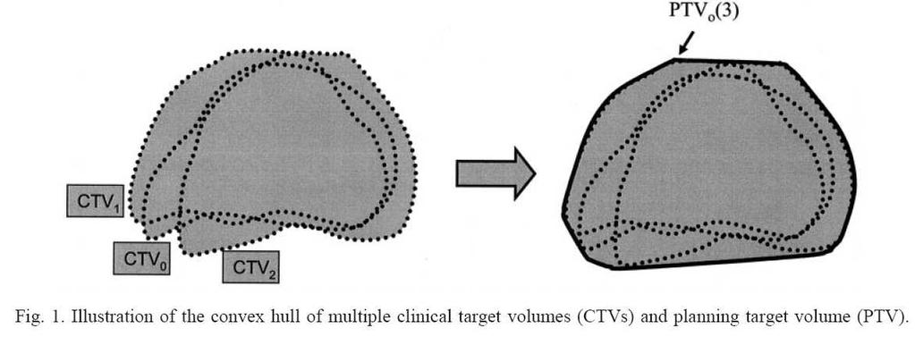 Patient-specific PTV for prostate cancer treatment - D. YAN et al.