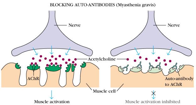 MALATTIE AUTOIMMUNI MEDIATE DA