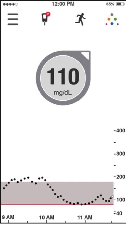 ESEMPIO: BOLO PREPRANDIALE Target glicemico : 110 mg/dl for target glucose; Rapporto Ins/CHO: 1:15 Fattore di correzione:1:50 mg/dl. Quantità carboidrati : 45 g carbohydrate.