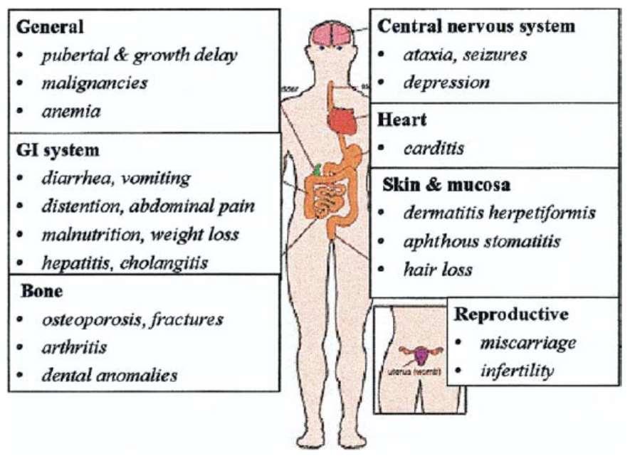 Celiachia Atipica - Sintomi - non gastrointestinali Anemia Dermatite erpetiforme Bassa statura Dolori ossei e fratture patologiche Problemi ginecologici (aborti ripetuti) Ipoplasia dello